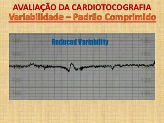AVALIAÇÃO DA CARDIOTOCOGRAFIA
 