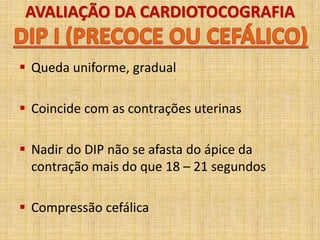 AVALIAÇÃO DA CARDIOTOCOGRAFIA
 Queda uniforme, gradual
 Coincide com as contrações uterinas
 Nadir do DIP não se afasta do ápice da
contração mais do que 18 – 21 segundos
 Compressão cefálica
 