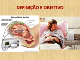 DEFINIÇÃO E OBJETIVO
 