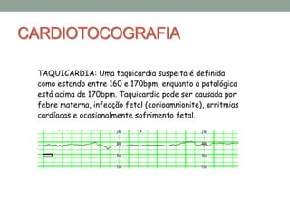 CARDIOTOCOGRAFIA
TAQUICARDIA: Uma taquicardia suspeita é definida
como estando entre 160 e 170bpm, enquanto a patológica
está acima de 170bpm. Taquicardia pode ser causada por
febre materna, infecção fetal (corioamnionite), arritmias
cardíacas e ocasionalmente sofrimento fetal.
 