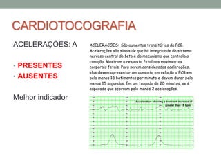 CARDIOTOCOGRAFIA
ACELERAÇÕES: A
• PRESENTES
• AUSENTES
Melhor indicador
ACELERAÇÕES: São aumentos transitórios da FCB.
Acelerações são sinais de que há integridade do sistema
nervoso central do feto e do mecanismo que controla o
coração. Mostram a resposta fetal aos movimentos
corporais fetais. Para serem consideradas acelerações,
elas devem apresentar um aumento em relação a FCB em
pelo menos 15 batimentos por minuto e devem durar pelo
menos 15 segundos. Em um traçado de 20 minutos, se é
esperado que ocorram pelo menos 2 acelerações.
 
