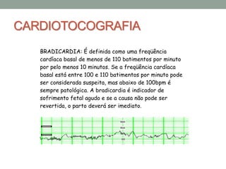 CARDIOTOCOGRAFIA
BRADICARDIA: É definida como uma freqüência
cardíaca basal de menos de 110 batimentos por minuto
por pelo menos 10 minutos. Se a freqüência cardíaca
basal está entre 100 e 110 batimentos por minuto pode
ser considerada suspeita, mas abaixo de 100bpm é
sempre patológica. A bradicardia é indicador de
sofrimento fetal agudo e se a causa não pode ser
revertida, o parto deverá ser imediato.
 