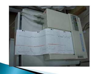 Cardiotocograph | PPTX