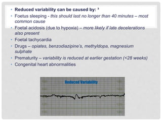 Cardiotocography | PPTX