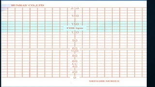 cardiotocography by Dr Farhana Zahir.pptx