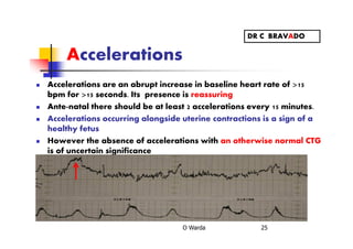 Accelerations
Accelerations are an abrupt increase in baseline heart rate of >15
bpm for >15 seconds. Its presence is reassuring
Ante-natal there should be at least 2 accelerations every 15 minutes.
Accelerations occurring alongside uterine contractions is a sign of a
healthy fetus
However the absence of accelerations with an otherwise normal CTG
is of uncertain significance
O Warda 25
DR C BRAVADO
 