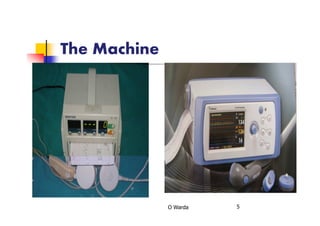 The Machine
O Warda 5
 