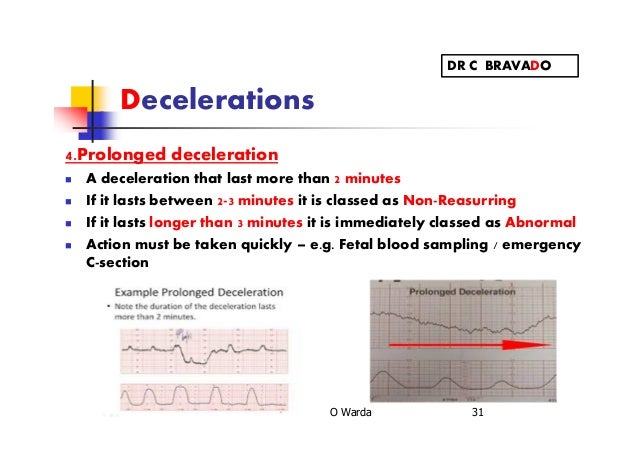 Cardiotocography (CTG) warda
