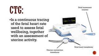Comprehensive Guide to Continuous CTG Monitoring in Pregnancy | PDF