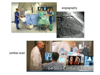 angiography




cardiac scan
 