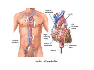 cardiac catheterization
 