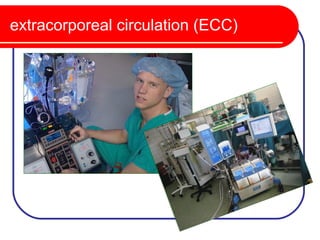 extracorporeal circulation (ECC)
 