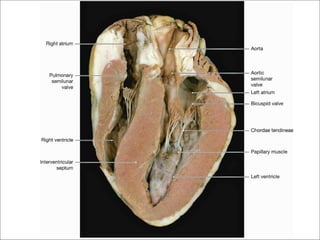 Figure 5.4 – Internal view of heart specimen illustrating
      heart chambers, septum, and heart valves.
 
