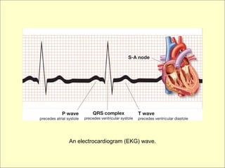 An electrocardiogram (EKG) wave.
 
