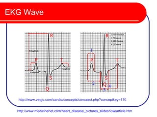 EKG Wave




  http://www.vetgo.com/cardio/concepts/concsect.php?conceptkey=170


  http://www.medicinenet.com/heart_disease_pictures_slideshow/article.htm
 