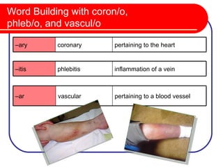 Word Building with coron/o,
phleb/o, and vascul/o

 –ary      coronary     pertaining to the heart


 –itis     phlebitis    inflammation of a vein



 –ar       vascular     pertaining to a blood vessel
 