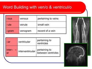 Word Building with ven/o & ventricul/o

  –ous       venous         pertaining to veins

  –ule       venule         small vein

  –gram      venogram       record of a vein


                            pertaining to
  –ar       ventricular
                            ventricles

  inter– –                  pertaining to
           interventricular
  ar                        between ventricles
 