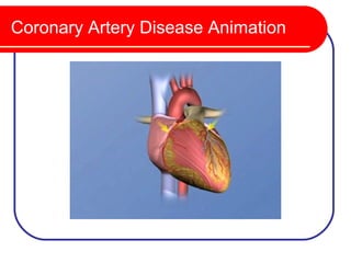 Coronary Artery Disease Animation
 