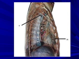 7.   CAVIDADES

Aurícula izquierda: Tiene una estructura que es una
    dilatación que rodea las cuatro venas pulmonares
 ...