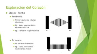 Exploración del Corazón
 Soplos – Forma
 Romboidal
 Primero aumenta y luego
disminuye
 Ej.: Soplo mesosistólico –
estenosis aórtica
 Ej.: Soplos de flujo inocentes
 En meseta
 No varía en intensidad
 Ej.: Soplo pansistólico –
insuficiencia mitral
 