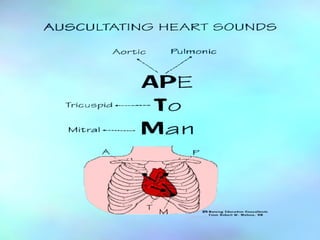 Auscultation Heart sounds 