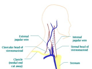 Jugular Vein Drawing 