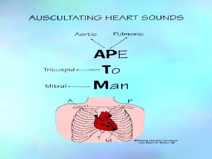 Z Pattern Heart Sounds | cardiovascular 330 ss 09 Z Pattern Heart Sounds | cardiovascular 330 ss 09