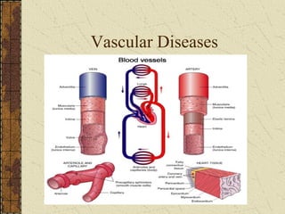 Vascular Diseases 