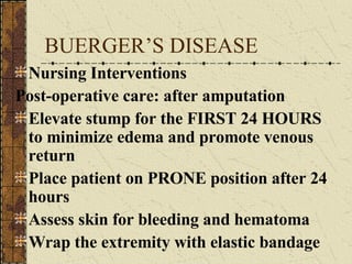 BUERGER’S DISEASE Nursing Interventions Post-operative care: after amputation Elevate stump for the FIRST 24 HOURS to minimize edema and promote venous return Place patient on PRONE position after 24 hours Assess skin for bleeding and hematoma Wrap the extremity with elastic bandage 