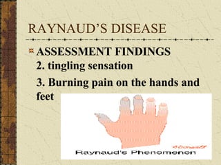 RAYNAUD’S DISEASE ASSESSMENT FINDINGS 2. tingling sensation 3. Burning pain on the hands and feet 