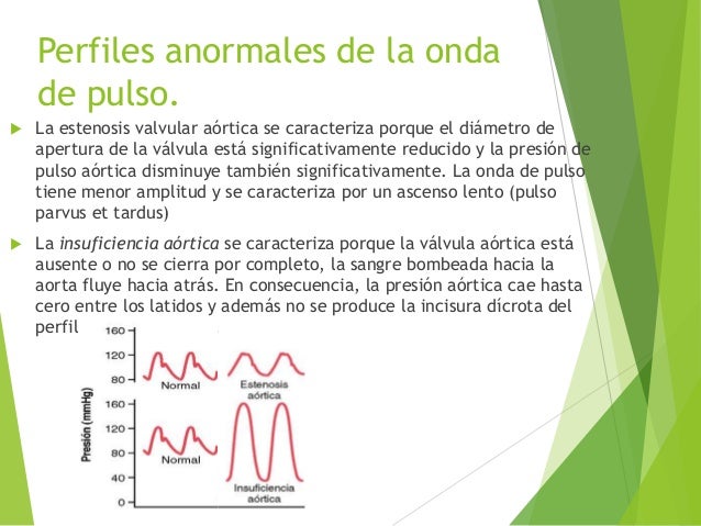 Pulsos e ondas