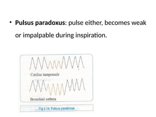 • Pulsus paradoxus: pulse either, becomes weak
or impalpable during inspiration.
 