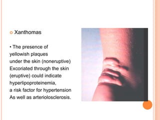  Xanthomas
• The presence of
yellowish plaques
under the skin (noneruptive)
Excoriated through the skin
(eruptive) could indicate
hyperlipoproteinemia,
a risk factor for hypertension
As well as arteriolosclerosis.
 