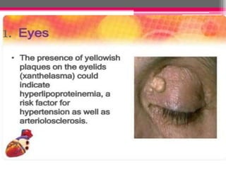 Xanthopsia Simulation Cardio vascular assessment | PPTX