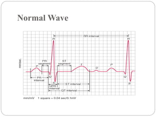Cardiovascular assessment and diagnostic investigations ppt slideshare ...