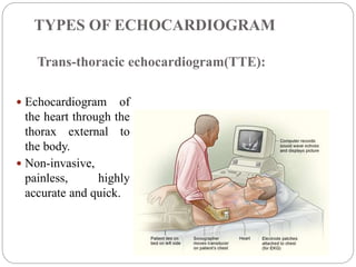 Tte Monitoring Cardiovascular assessment and diagnostic investigations ppt slideshare ...