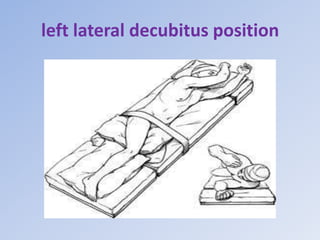 left lateral decubitus position
 