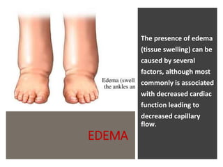 EDEMA
The presence of edema
(tissue swelling) can be
caused by several
factors, although most
commonly is associated
with decreased cardiac
function leading to
decreased capillary
flow.
 