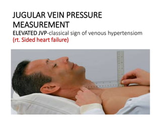 JUGULAR VEIN PRESSURE
MEASUREMENT
ELEVATED JVP-classical sign of venous hypertensiom
(rt. Sided heart failure)
 