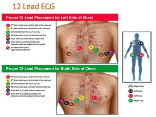 12 Lead ECG
 