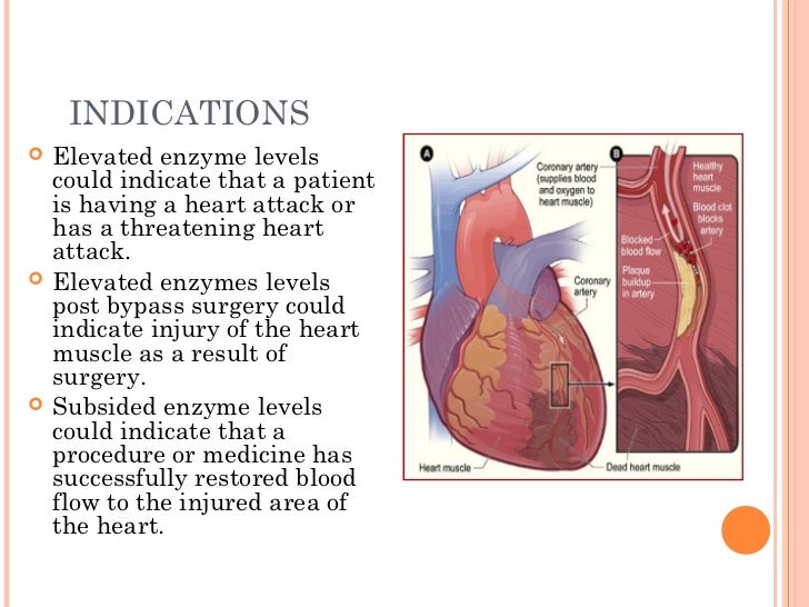 Cardiovascular diagnostic procedures