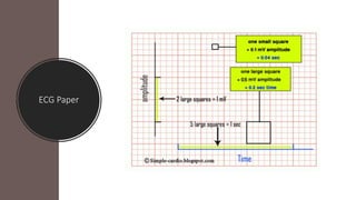 ECG Paper
 