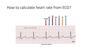How to calculate heart rate from ECG?
 