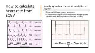 How to calculate
heart rate from
ECG?
Calculating the heart rate when the rhythm is
regular
• There are 300 large squares per minute
• If the rhythm is regular count the number of large squares
between two QRS complexes and divide it into 300
 