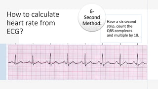 How to calculate
heart rate from
ECG?
Have a six second
strip, count the
QRS complexes
and multiple by 10.
6-
Second
Method:
 