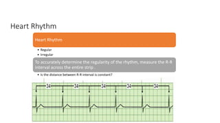 Heart Rhythm
Heart Rhythm
• Regular
• Irregular
To accurately determine the regularity of the rhythm, measure the R-R
interval across the entire strip .
• Is the distance between R-R interval is constant?
 