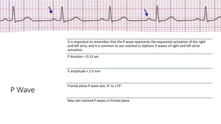P Wave
It is important to remember that the P wave represents the sequential activation of the right
and left atria, and it is common to see notched or biphasic P waves of right and left atrial
activation.
P duration < 0.12 sec
P amplitude < 2.5 mm
Frontal plane P wave axis: 0° to +75°
May see notched P waves in frontal plane
 