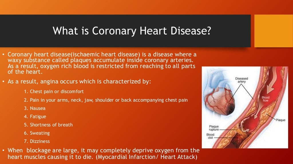 Cardiovascular disease and smoking