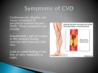  Cardiovascular disease, can
cause symptoms of
peripheral arterial disease
(PAD). These symptoms can
include:
 Claudication- pain or cramp
in the muscles during
exercise and improves with
rest.
 Cold or numb feeling in the
feet or toes, especially at
night.
 