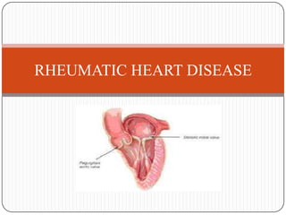 RHEUMATIC HEART DISEASE
 